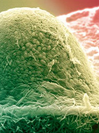 Bild zeigt: elektronenmikroskopische Aufnahme von Myxococcus xanthus-Bakterien, die sich zu einem Fruchtkörper zusammenschließen